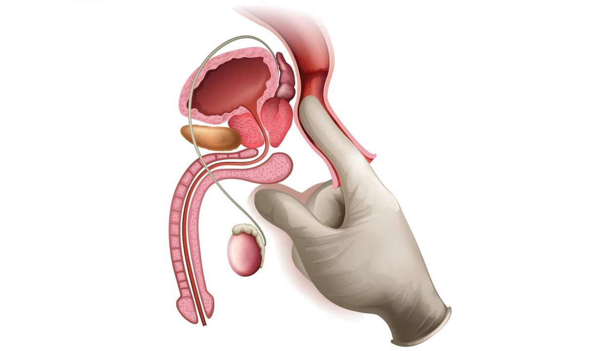 Prostate massage for prostate
